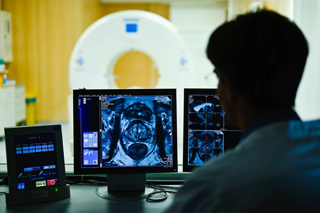 Cutbacks in Screening