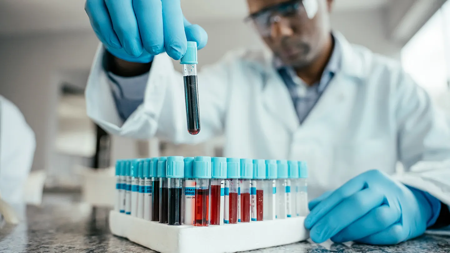 Experimental blood er